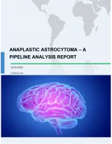 Anaplastic Astrocytoma - A Pipeline Analysis Report
